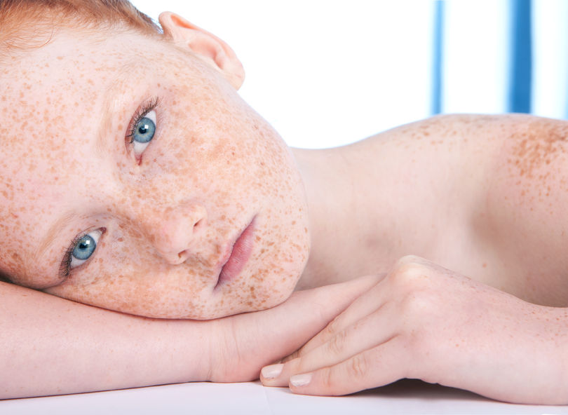 Если веснушки нежелательны...