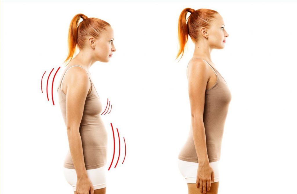 Как избавиться от сутулости и расправить плечи?